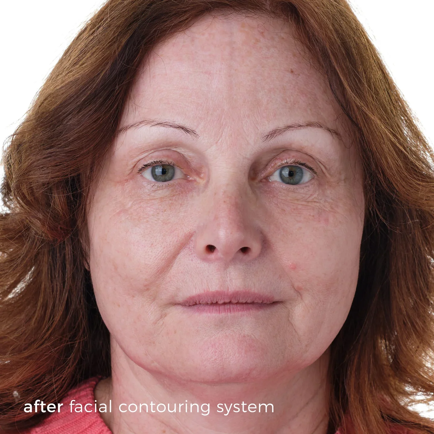 Skinbunny Facial Contouring System with Long Lasting Moisturiser - Image 8