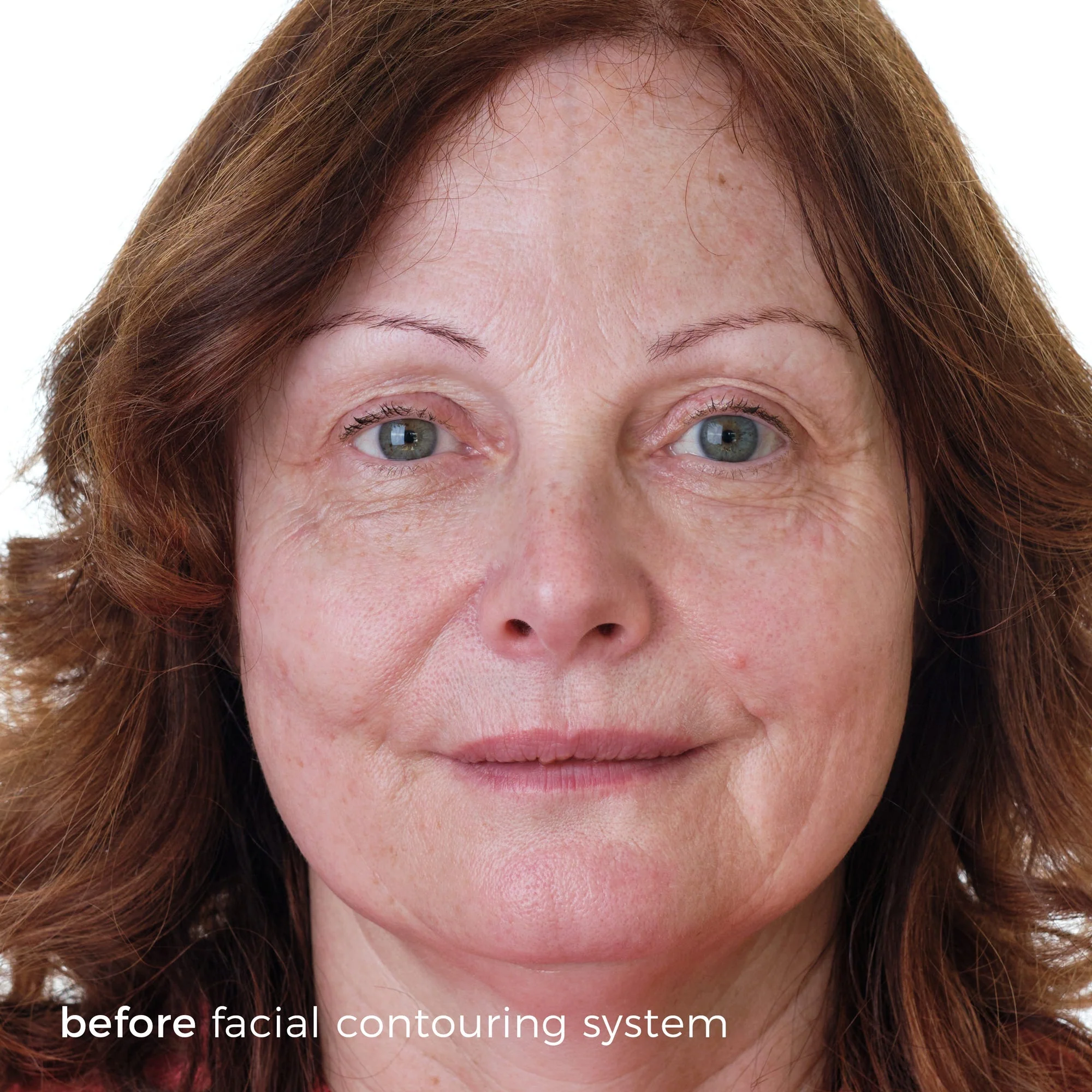 Skinbunny Facial Contouring System - Image 4