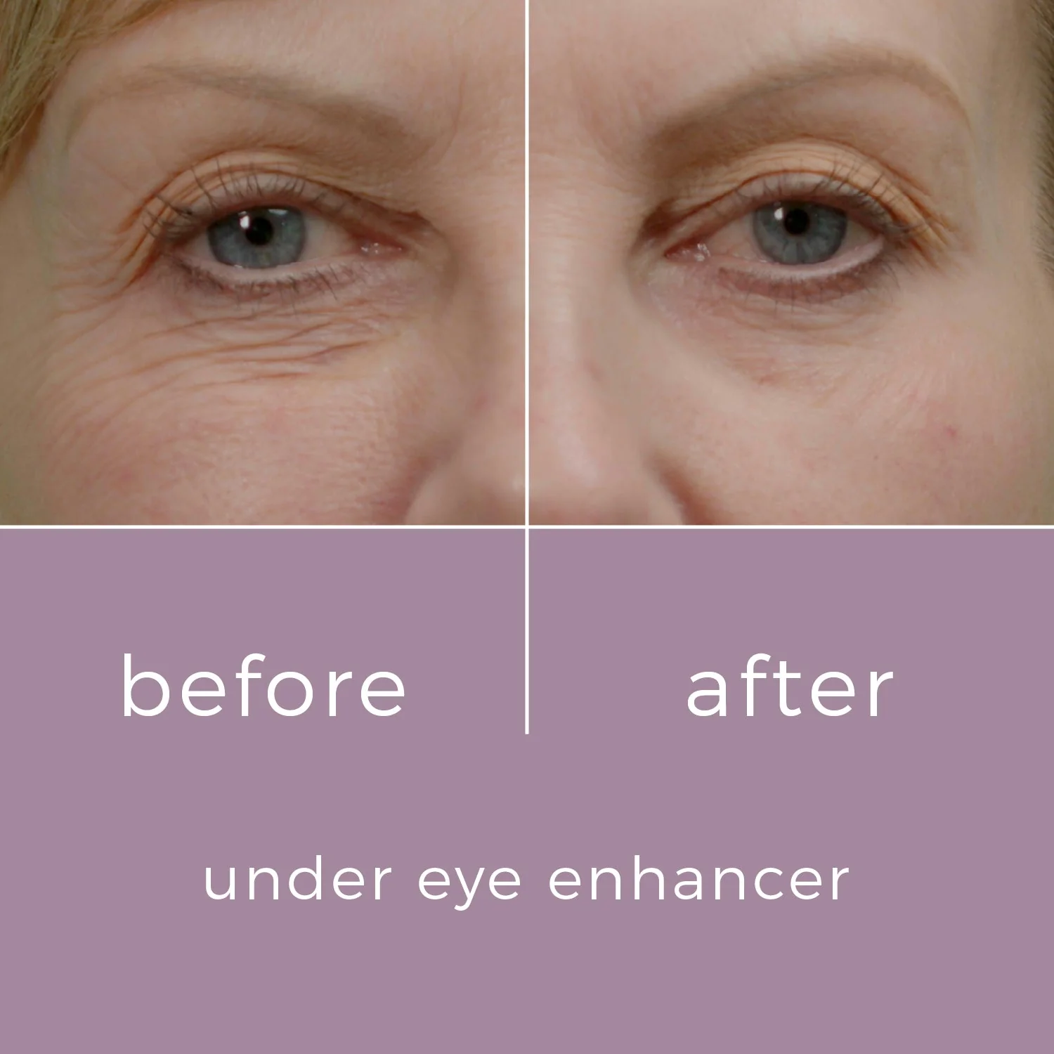 Skinbunny Under Eye Enhancer with Blue Tansy Night Oil - Image 11