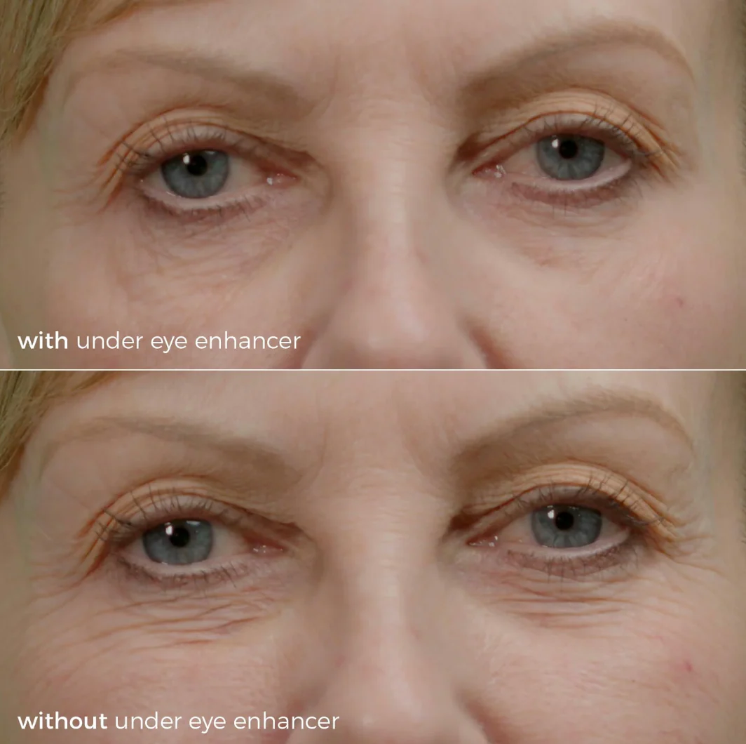 Skinbunny Under Eye Enhancer with Blue Tansy Night Oil - Image 12