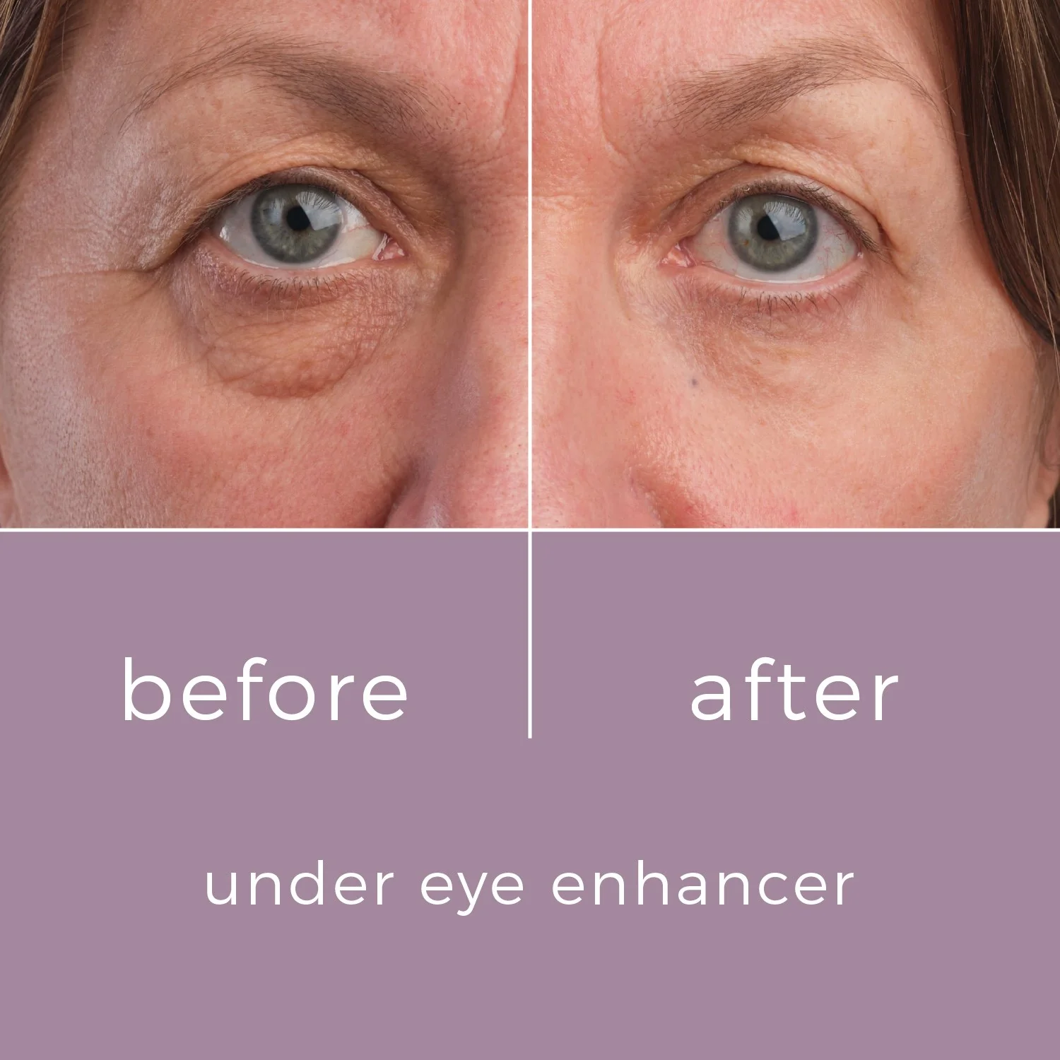 Skinbunny Under Eye Enhancer with Blue Tansy Night Oil - Image 7
