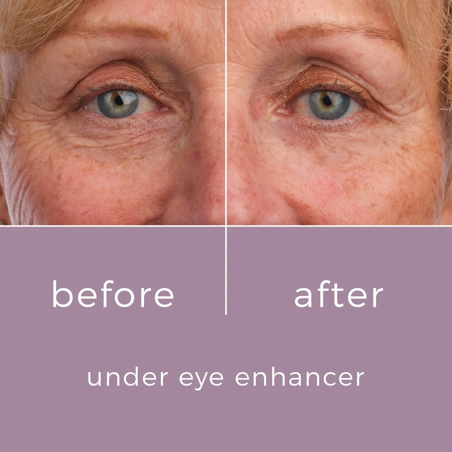 Skinbunny Under Eye Enhancer with Blue Tansy Night Oil - Image 8